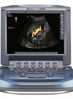 Sonosite Micromaxx