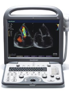 Sonoscape S8