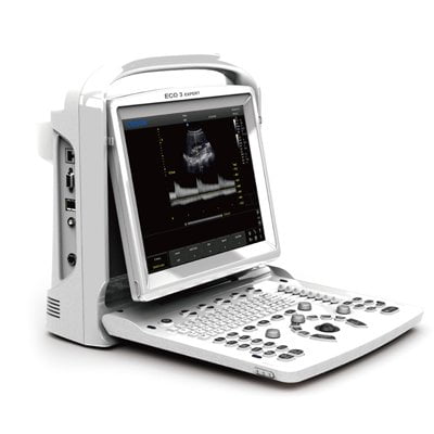 Chison ECO3 EXPERT