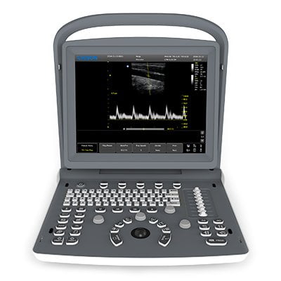 Chison ECO2