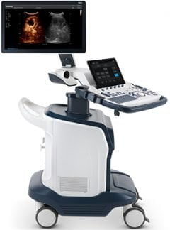 Sonoscape S60