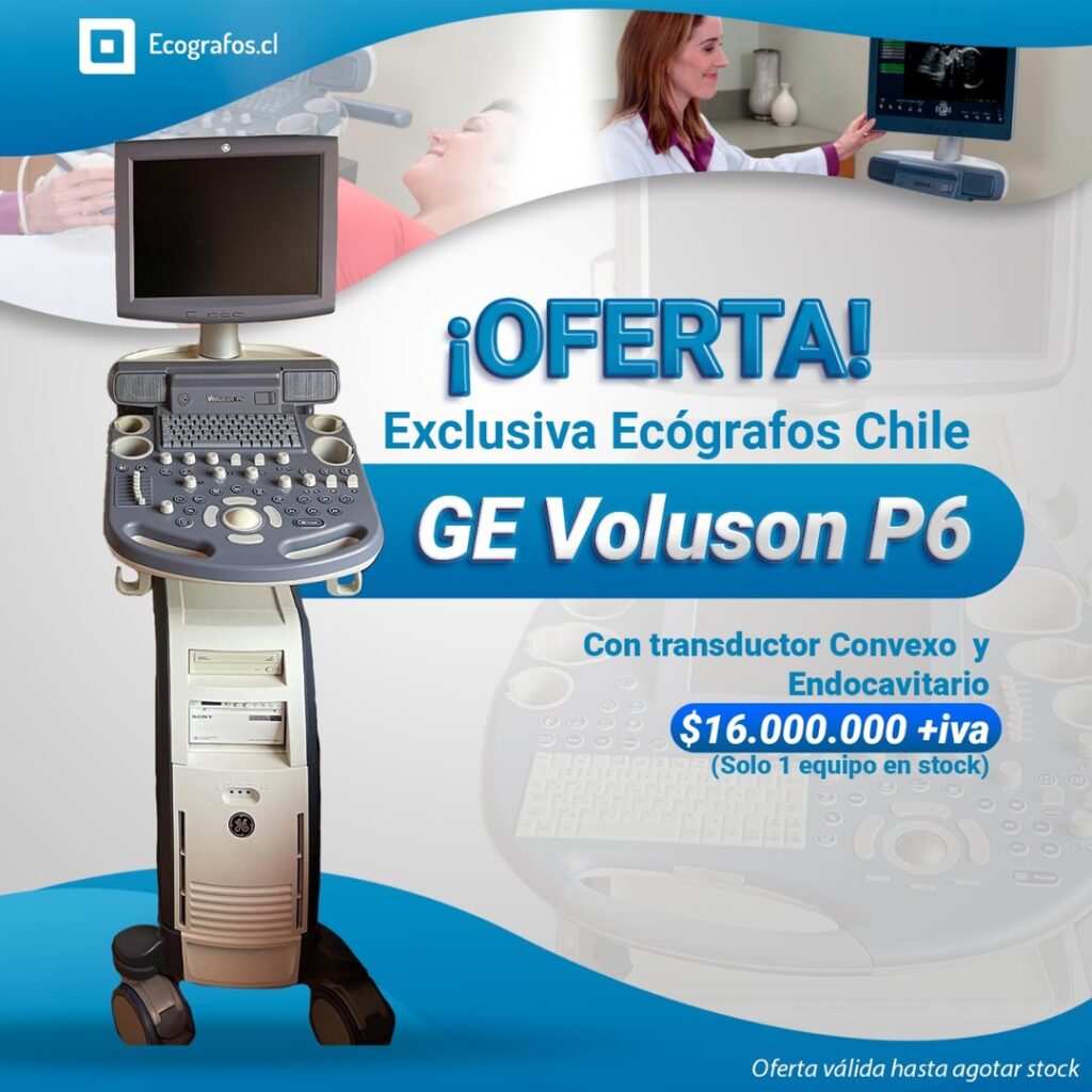 Necesitas un Equipo confiable para Ginecología y obstetricia, imágenes abdominales de calidad.
Este equipo es para ti!
(Convexo y endocavitario 2D)
Agenda tu Demostración,
Estamos Ubicados en
Av. Vitacura 2909, of 1202, Las condes.
Cotiza y se parte de nuestra empresa.
Equipos reacondicionados de las mejores marcas.
números de contacto.
+56227522050 +56995903984 +56968121812
https://www.ecografos.cl/
#ecografos #generalelectric #samsung #salud #toshiba #siemens #gine #ginecologia #equiposmedicos #cardiologo #doctor #medico #philips #tecnologo #chile #medicina #medison #cardiologia #radiologia #cardiologia #gineco #vivid #voluson #clinica #ecografia #ecotomografo #centromedico
