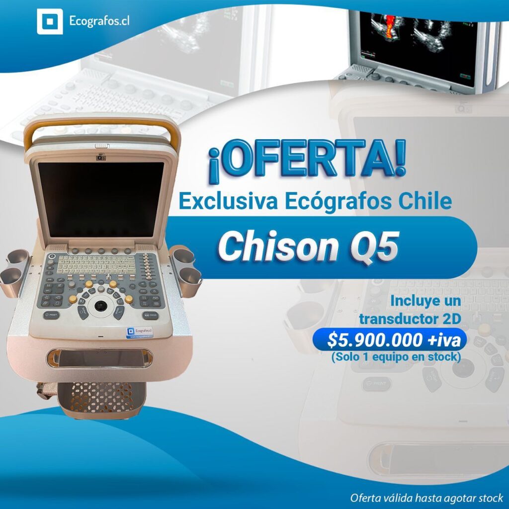 Ecógrafo de ocasión, multipropósito, ideal para gineco obstetricia a un excelente precio.
Incluye un transductor 2D
Agenda tu Demostración,
Estamos Ubicados en
Av. Vitacura 2909, of 1202, Las condes.
Cotiza y se parte de nuestra empresa.
Equipos reacondicionados de las mejores marcas.
números de contacto.
+56227522050 +56995903984 +56968121812
https://www.ecografos.cl/
#ecografos #chison #generalelectric #samsung #salud #toshiba #siemens #gine #ginecologia #equiposmedicos #cardiologo #doctor #medico #philips #tecnologo #chile #medicina #medison #cardiologia #radiologia #cardiologia #gineco #vivid #voluson #clinica #ecografia #ecotomografo #centromedico