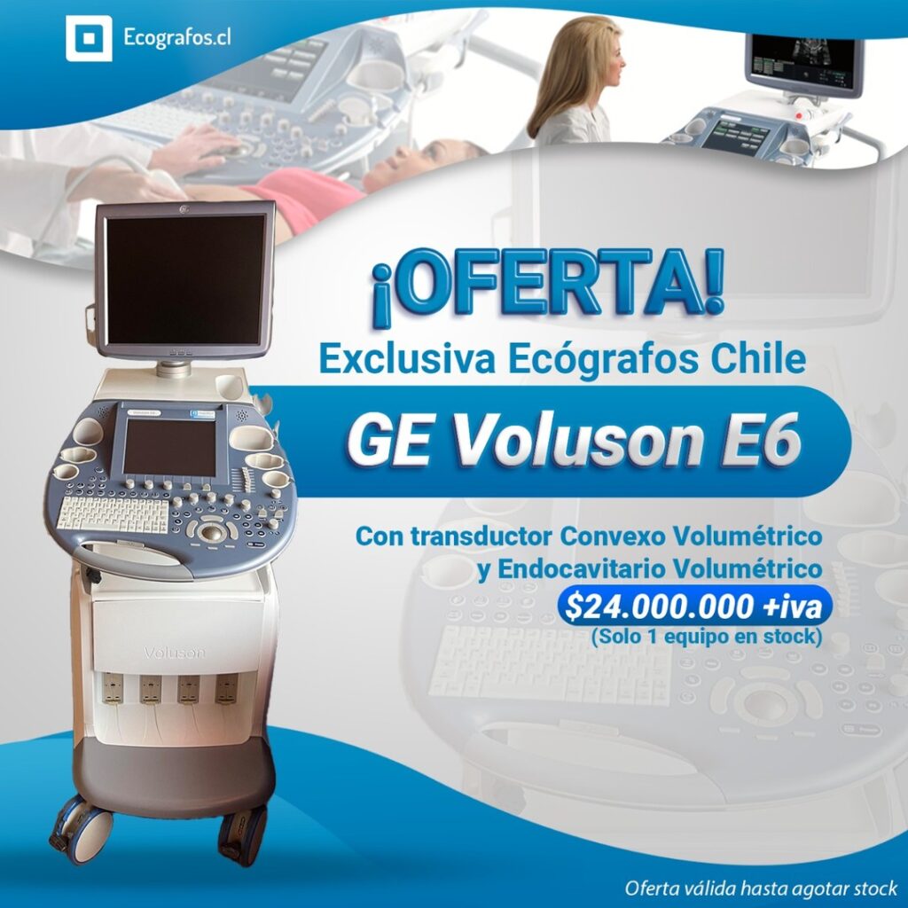 Increíble equipo para Ginecología y obstetricia, imágenes abdominales y Endocavitarias 4D, HDlive de calidad.
Si quieres uno de los equipos mas completos a un excelente precio este ecógrafo es para ti!
(Convexo y endocavitario Volumétricos)
Agenda tu Demostración,
Estamos Ubicados en
Av. Vitacura 2909, of 1202, Las condes.
Cotiza y se parte de nuestra empresa.
Equipos reacondicionados de las mejores marcas.
números de contacto.
+56227522050 +56995903984 +56968121812
https://www.ecografos.cl/
#ecografos #generalelectric #samsung #salud #toshiba #siemens #gine #ginecologia #equiposmedicos #cardiologo #doctor #medico #philips #tecnologo #chile #medicina #medison #cardiologia #radiologia #cardiologia #gineco #vivid #voluson #clinica #ecografia #ecotomografo #centromedico