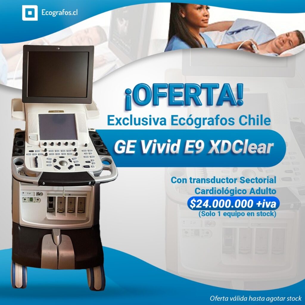 Necesitas un ecógrafo cardiológico top de linea , exámenes de alta complejidad y excelentes prestaciones cardiológicas a un precio accesible este ecógrafo es para ti!
Incluye transductor sectorial cardiológico adulto.
Agenda tu Demostración,
Estamos Ubicados en
Av. Vitacura 2909, of 1202, Las condes.
Cotiza y se parte de nuestra empresa.
Equipos reacondicionados de las mejores marcas.
números de contacto.
+56227522050 +56995903984 +56968121812
https://www.ecografos.cl/
#ecografos #generalelectric #samsung #salud #toshiba #siemens #gine #ginecologia #equiposmedicos #cardiologo #doctor #medico #philips #tecnologo #chile #medicina #medison #cardiologia #radiologia #cardiologia #gineco #vivid #voluson #clinica #ecografia #ecotomografo #centromedico