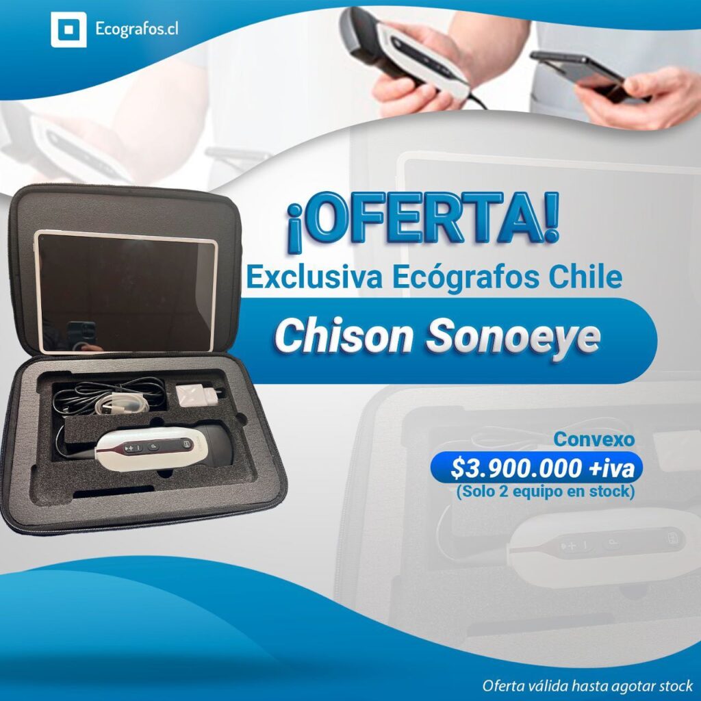 Ecógrafo Doppler color ultra portátil Eco fast, imágenes abdominales.
Este equipo es para ti!
Solo convexo
Cotiza y se parte de nuestra empresa.
Equipos Nuevos Chison y Reacondicionados de las mejores marcas.
números de contacto.
+56995903984 +56968121812
https://www.ecografos.cl/
#ecografos #chison #generalelectric #samsung #salud #toshiba #siemens #equiposmedicos #cardiologo #doctor #medico #philips #tecnologo #chile #medicina #medison #cardiologia #radiologia #cardiologia #gineco #vivid #voluson #clinica #ecografia #ecotomografo #centromedico