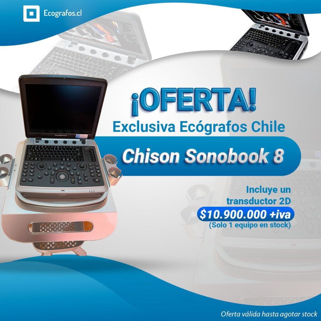 Ecógrafo multipropósito, con muy buena imagen incorpora mediciones cardiológicas , ginecología y obstetricia.
Disponible para Vet y humano.
Incluye un transductor 2D
Agenda tu Demostración,
Estamos Ubicados en
Av. Vitacura 2909, of 1202, Las condes.
Cotiza y se parte de nuestra empresa.
Equipos reacondicionados de las mejores marcas.
números de contacto.
+56227522050 +56995903984 +56968121812
https://www.ecografos.cl/
#ecografos #chison #generalelectric #samsung #salud #toshiba #siemens #gine #ginecologia #equiposmedicos #cardiologo #doctor #medico #philips #tecnologo #chile #medicina #medison #cardiologia #radiologia #cardiologia #gineco #vivid #voluson #clinica #ecografia #ecotomografo #centromedico