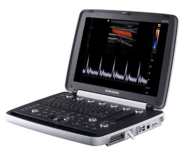 0 Samsung HM70A Ultrasound Machine Scanner System white background UDS no probes or transducers