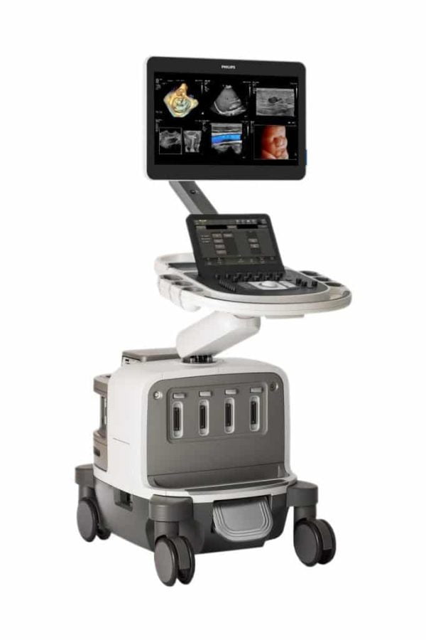 Philips EPIQ Elite ultrasound system.download