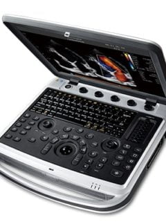 Chison Sonobook 8
