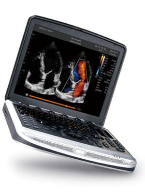 Chison Sonobook 8 7 Chison Sonobook 8