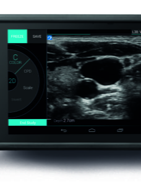 IVIZ FRONT TOP DOWN RT CMYK Vascular Image White BG scaled