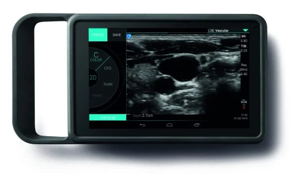 Sonosite IVIZ