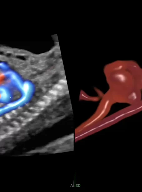 18-week-aortic-arch_thumbnail
