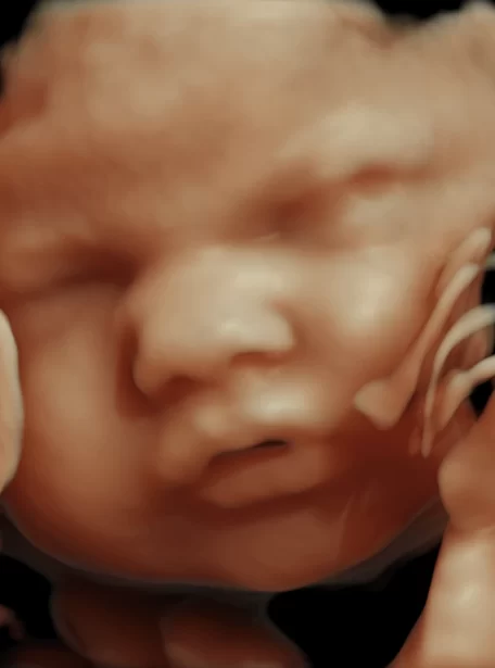 33-week-fetal-face_03