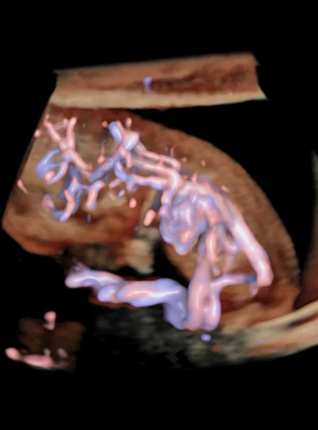 9-week-circulatory-system