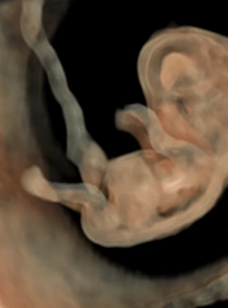 9-week-embryo_05