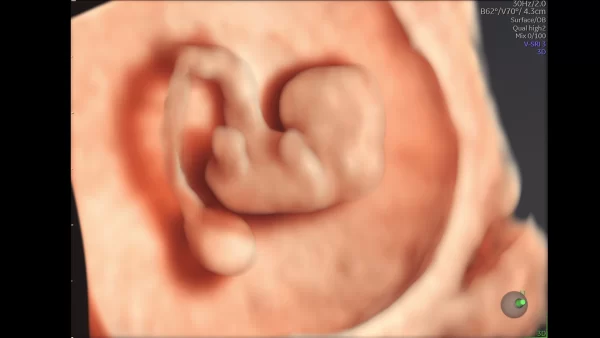 embryo image