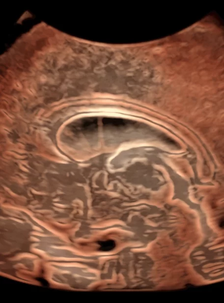 fetus-brain-image (1)