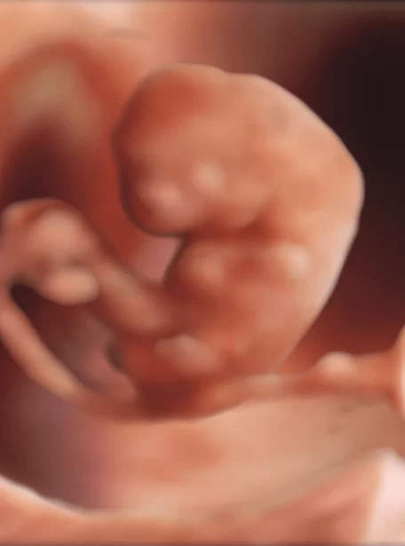 hdlivestudio-image-of-7-week-embryo
