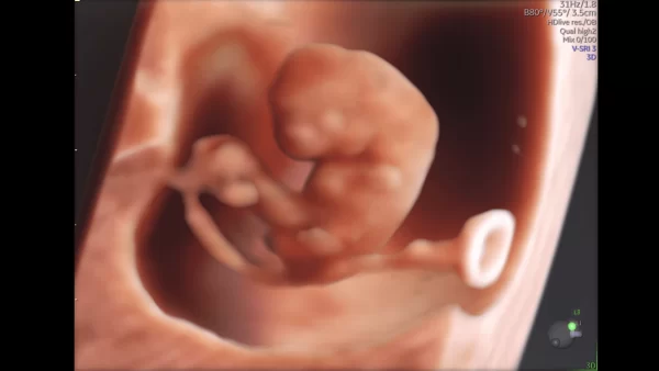 hdlivestudio image of 7 week embryo