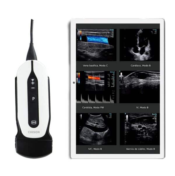 ecgrafo porttil chison sonoeye p5 sonda convexa 35mhz tablet de regalo 1663854324 1