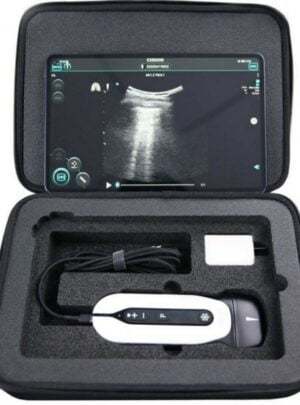 Chison Sonoeye 6 Chison Sonoeye