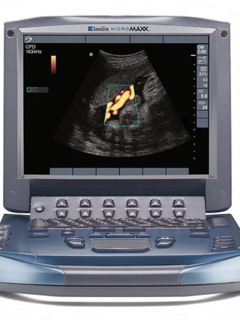 Sonosite Micromaxx