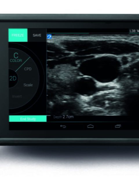 Sonosite IVIZ