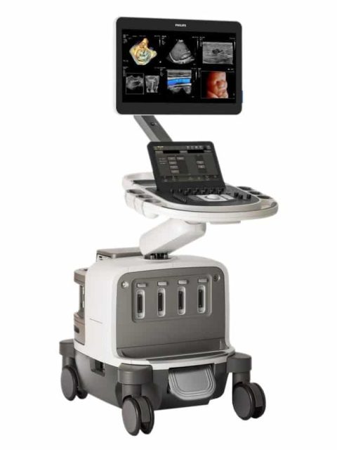 Philips EPIQ Elite ultrasound system.download qfrfy19u0pctpcd4cjz43vm2l2fiemciaywskgugw0