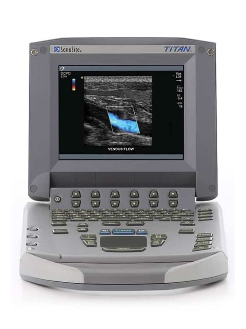 Sonosite Titan