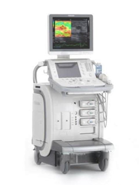 Toshiba Aplio 300