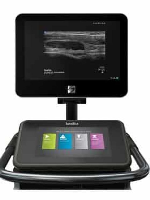 Sonosite X-PORTE